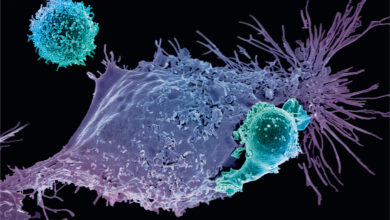Photo of Combo of cabozantinib plus atezolizumab active across kidney cancer subtypes