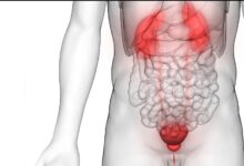 Photo of AROUND THE CORNER:Top Developments in Genitourinary Cancer Therapeutics